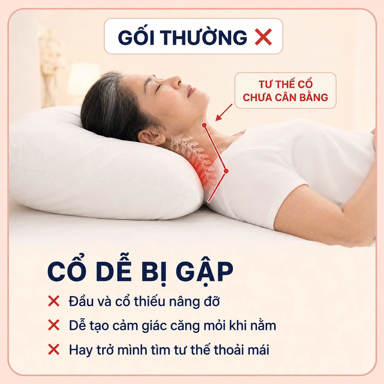 Gối thường — cổ dễ bị gập, đầu và cổ thiếu nâng đỡ khi nằm